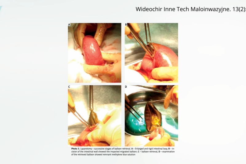 Sham Surgery Trials Reveal Questions About Efficacy of Popular Medical Interventions