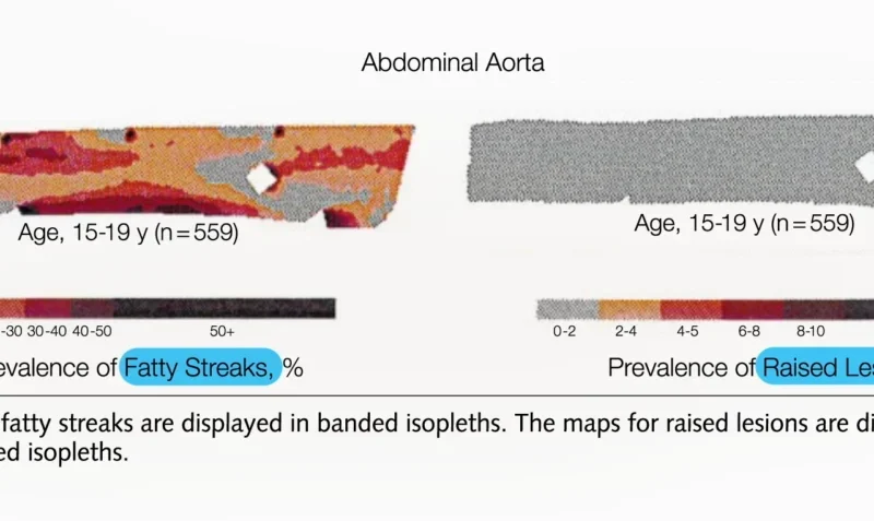 Atherosclerosis: The Silent Epidemic Beginning in Adolescence and Its Profound Implications for Lifelong Heart Health