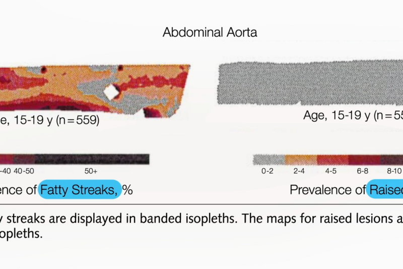 Atherosclerosis: The Silent Killer That Begins in Adolescence