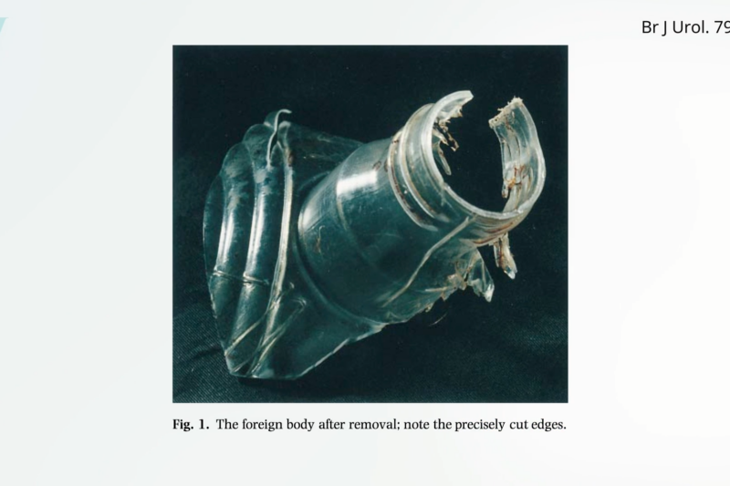 Mixed Nuts Put to the Test for Erectile Dysfunction