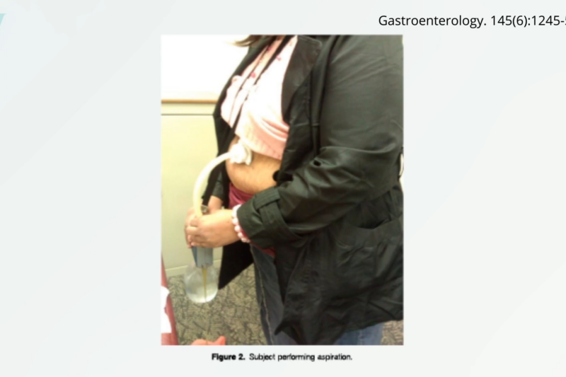 The Perilous Pursuit of Pounds: An Examination of Extreme and Questionable Weight-Loss Methods