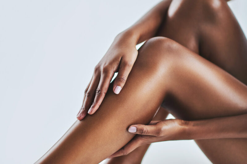 The Truth About Cellulite: Expert Insights on Reducing Its Appearance