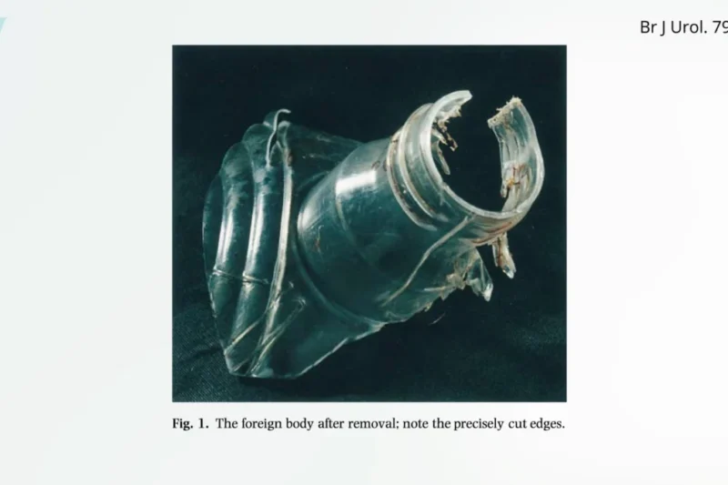 Mixed Nuts Put to the Test for Erectile Dysfunction