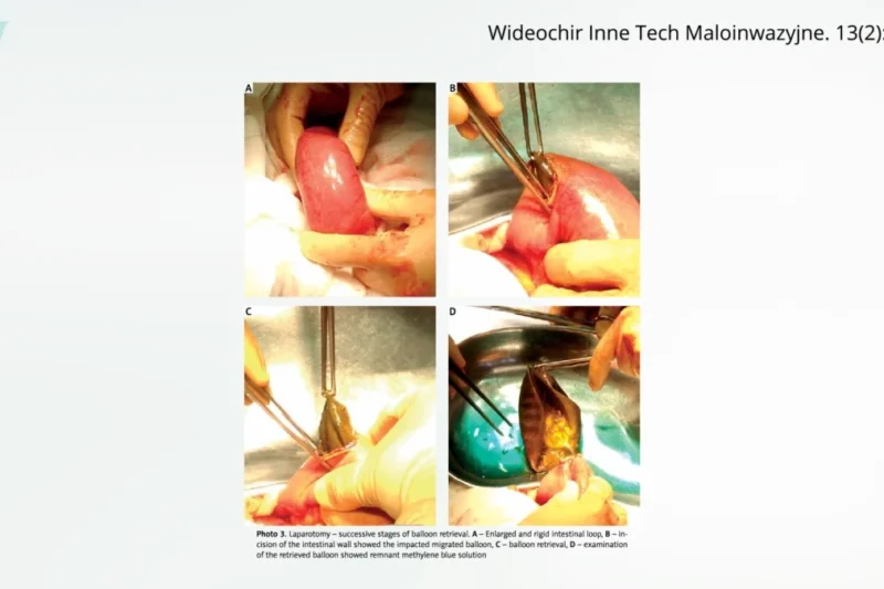 The Perilous Promise: Examining the Effectiveness and Safety of Popular Surgical Interventions