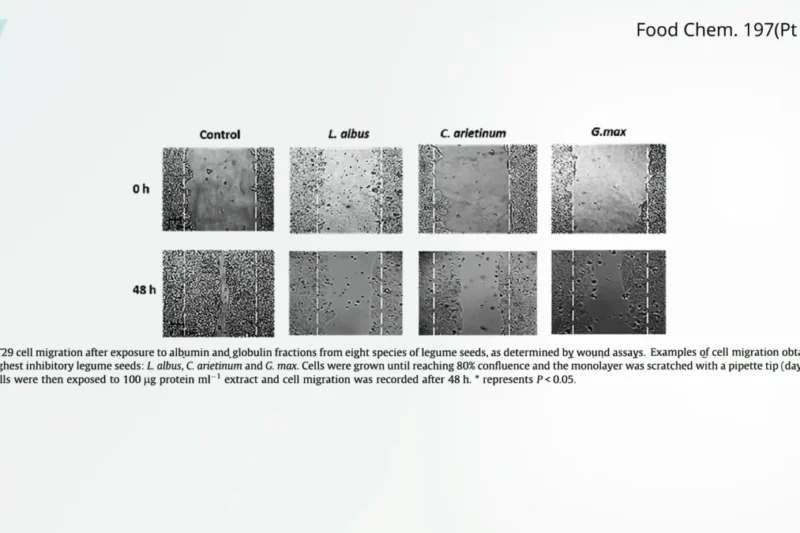 Legumes Lead the Charge in Inhibiting Cancer Metastasis Enzymes