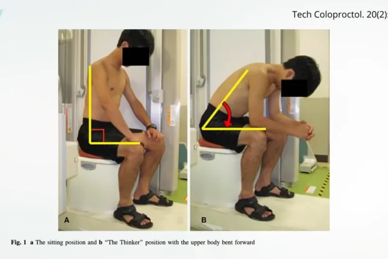 The Squatty Potty is Put to the Test