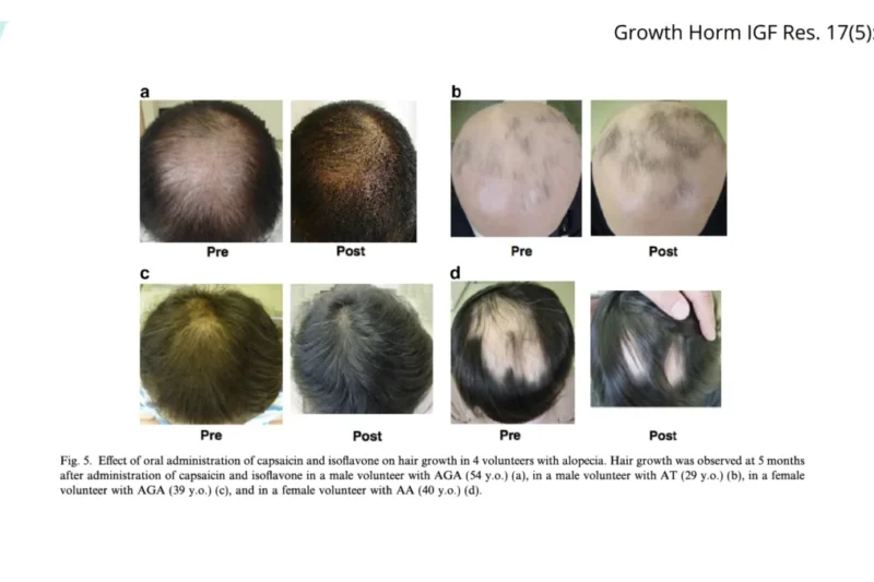 Hot Peppers, Soy Foods, and Pumpkin Seeds May Offer Promising Avenues for Addressing Hair Loss