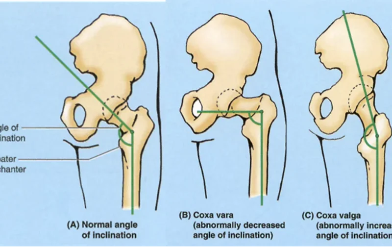 The Myth of Human Symmetry and the Evolution of Individualized Strength Training